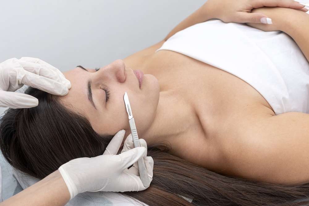 Dermaplaning Cape Coral FL