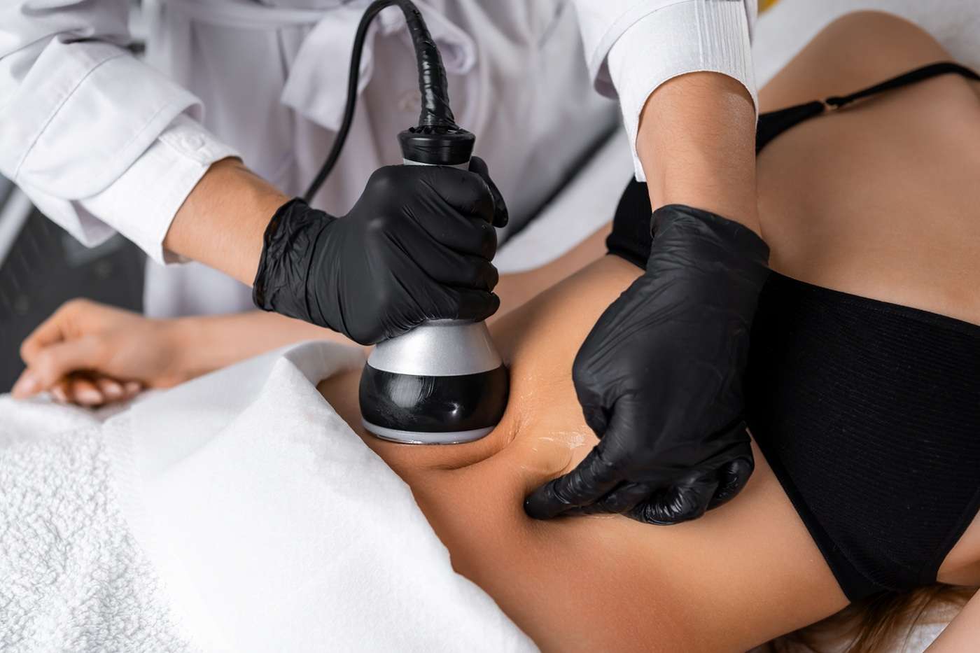 Cavitation Treatment Cape Coral
